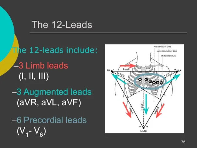 The 12-Leads The 12-leads include: 3 Limb leads (I, II, III)