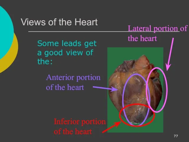 Views of the Heart Some leads get a good view of