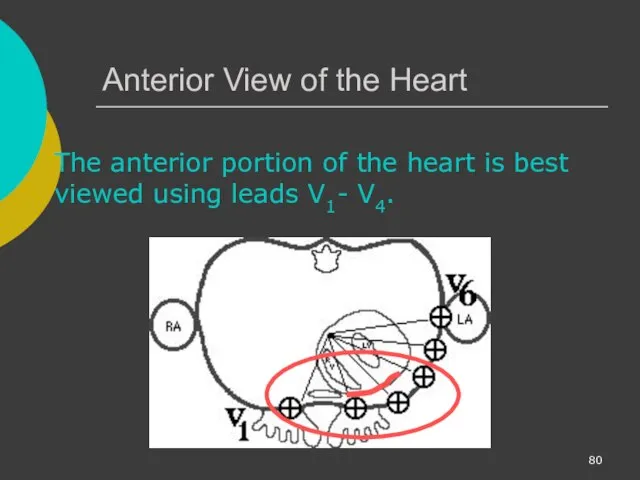 Anterior View of the Heart The anterior portion of the heart