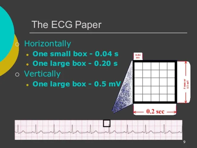 The ECG Paper Horizontally One small box - 0.04 s One