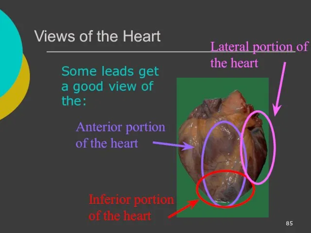 Views of the Heart Some leads get a good view of