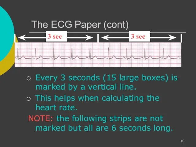 The ECG Paper (cont) Every 3 seconds (15 large boxes) is