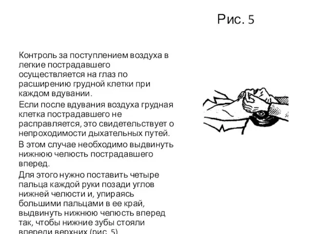 Рис. 5 Контроль за поступлением воздуха в легкие пострадавшего осуществляется на