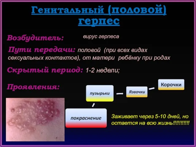 Генитальный (половой) герпес Возбудитель: Пути передачи: половой (при всех видах сексуальных