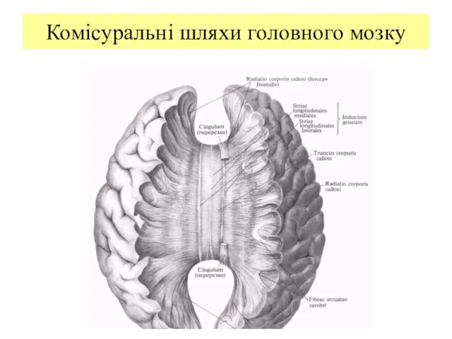 Комісуральні шляхи головного мозку