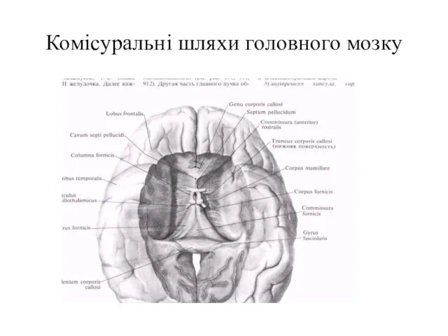 Комісуральні шляхи головного мозку