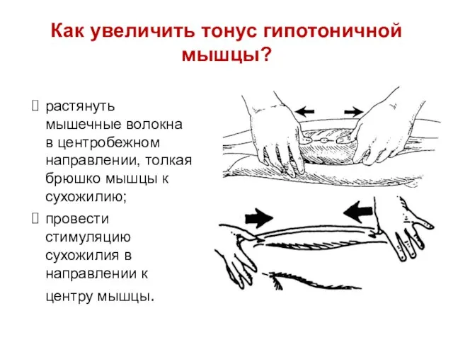 Как увеличить тонус гипотоничной мышцы? растянуть мышечные волокна в центробежном направлении,