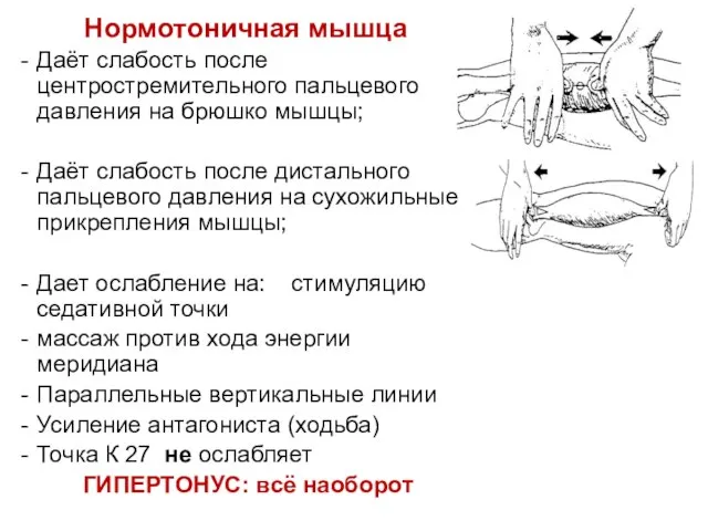 Нормотоничная мышца Даёт слабость после центростремительного пальцевого давления на брюшко мышцы;