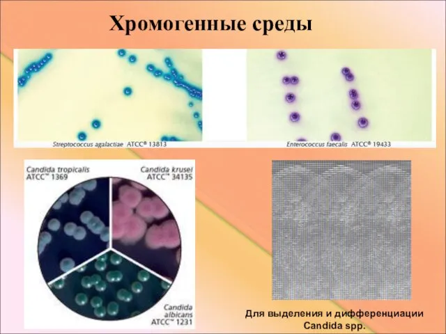 Хромогенные среды Для выделения и дифференциации Candida spp.