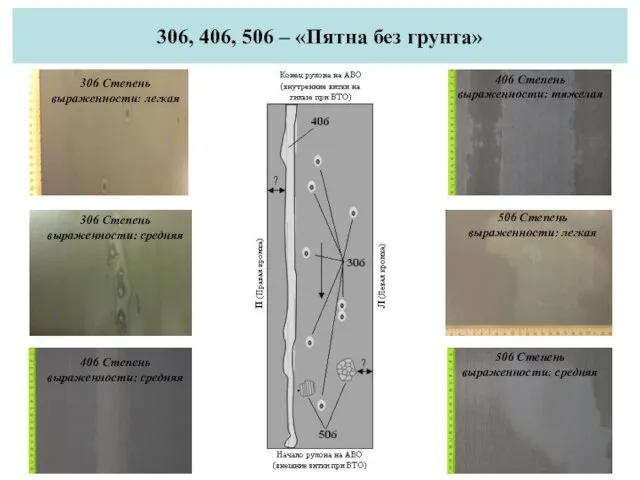 306, 406, 506 – «Пятна без грунта» 306 Степень выраженности: легкая