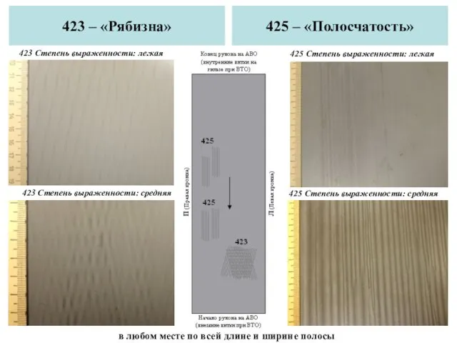 423 – «Рябизна» 425 – «Полосчатость» 423 Степень выраженности: средняя 423