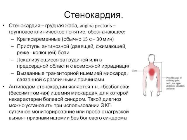 Стенокардия. Стенокардия – грудная жаба, angina pectoris – групповое клиническое понятие,