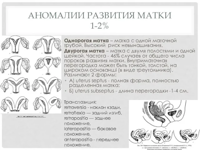 АНОМАЛИИ РАЗВИТИЯ МАТКИ 1-2% Однорогая матка – матка с одной маточной