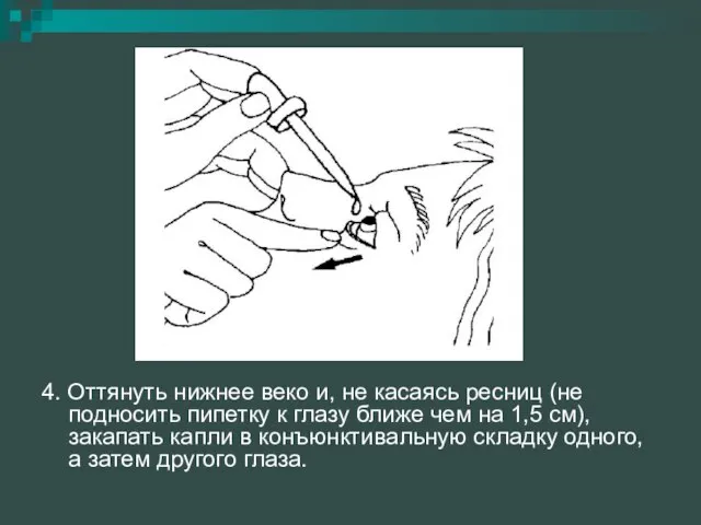 4. Оттянуть нижнее веко и, не касаясь ресниц (не подносить пипетку