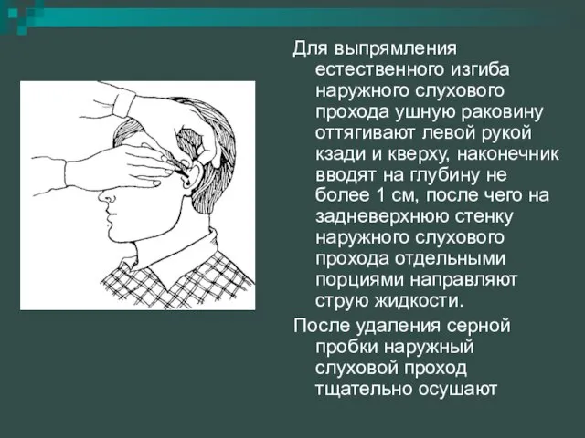 Для выпрямления естественного изгиба наружного слухового прохода ушную раковину оттягивают левой