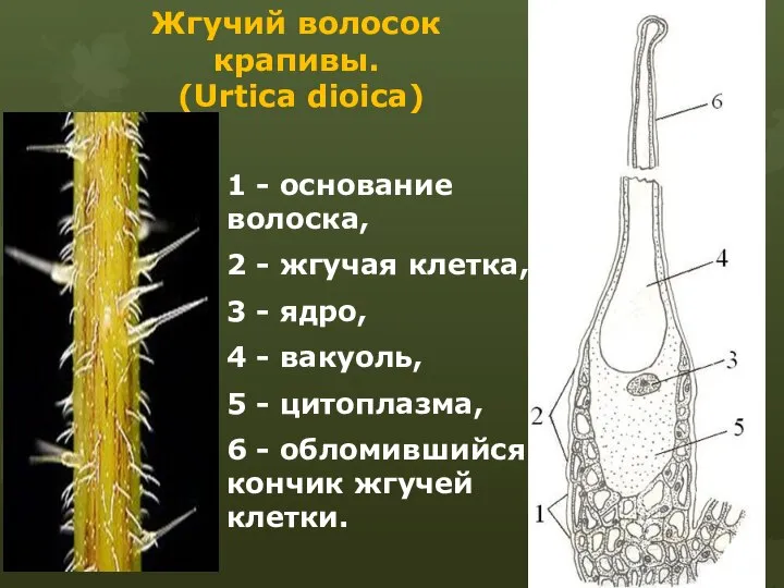 Жгучий волосок крапивы. (Urtica dioica) 1 - основание волоска, 2 -