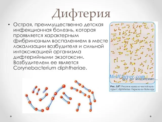 Дифтерия Острая, преимущественно детская инфекционная болезнь, которая проявляется характерным фибринозным воспалением