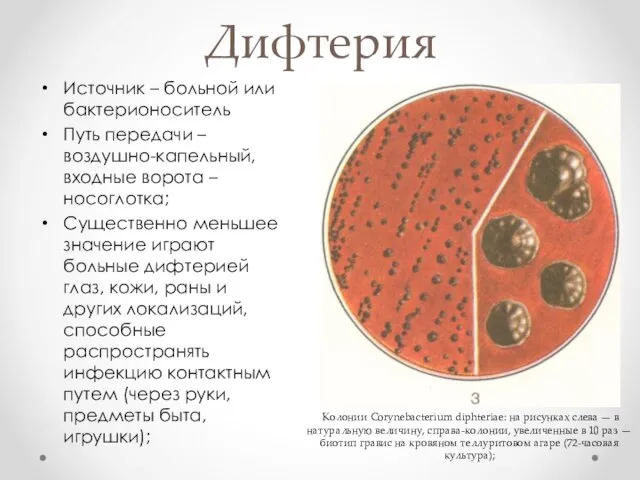 Источник – больной или бактерионоситель Путь передачи – воздушно-капельный, входные ворота