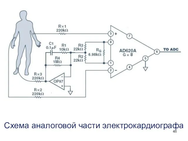 Схема аналоговой части электрокардиографа