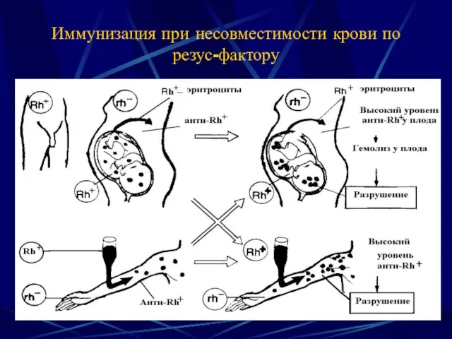 Иммунизация при несовместимости крови по резус-фактору