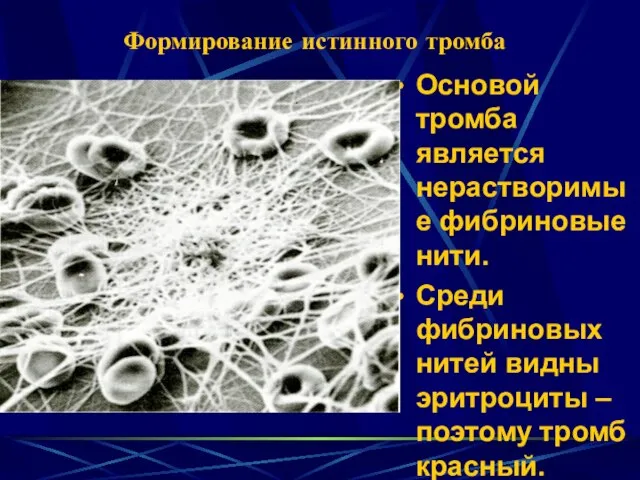 Формирование истинного тромба Основой тромба является нерастворимые фибриновые нити. Среди фибриновых