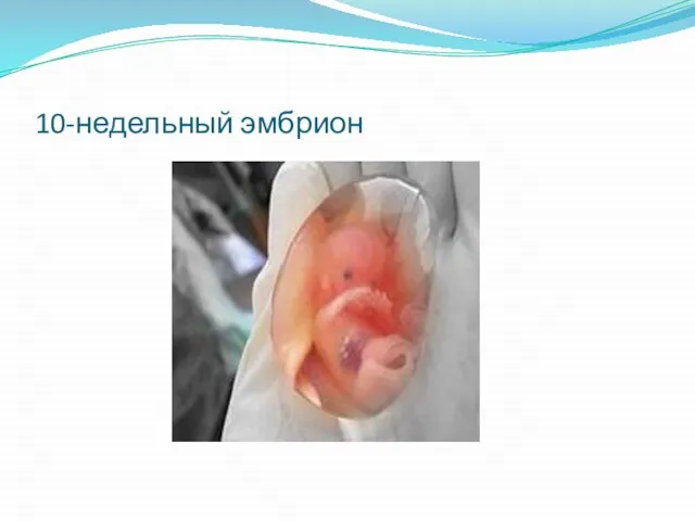 10-недельный эмбрион