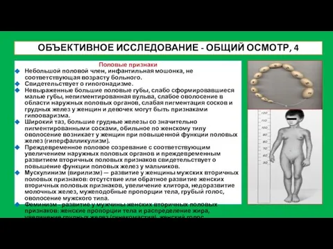 ОБЪЕКТИВНОЕ ИССЛЕДОВАНИЕ - ОБЩИЙ ОСМОТР, 4 Половые признаки Небольшой половой член,