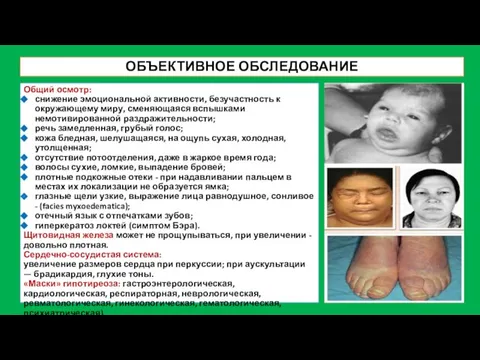 Общий осмотр: снижение эмоциональной активности, безучастность к окружающему миру, сменяющаяся вспышками