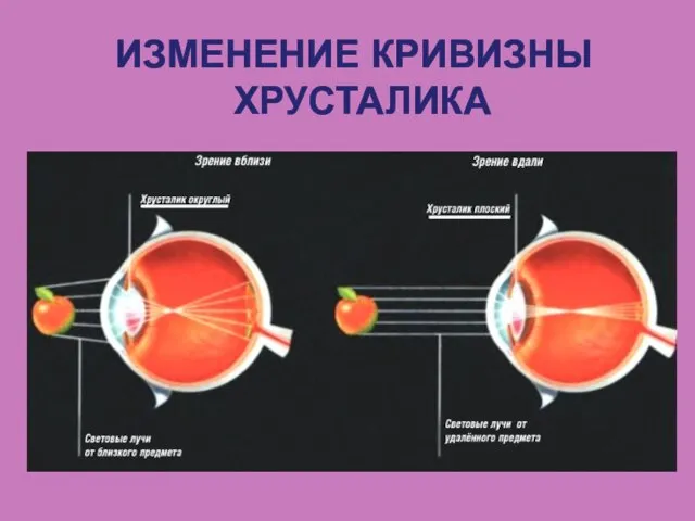 ИЗМЕНЕНИЕ КРИВИЗНЫ ХРУСТАЛИКА