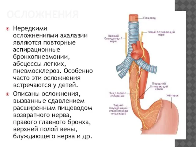 ОСЛОЖНЕНИЯ Нередкими осложнениями ахалазии являются повторные аспирационные бронхопневмонии, абсцессы легких, пневмосклероз.