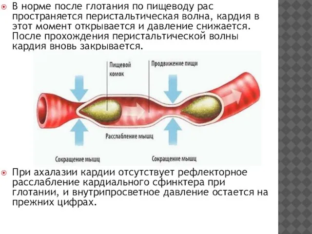 В норме после глотания по пищеводу рас­пространяется перистальтическая волна, кардия в