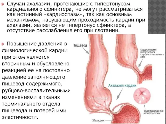 Случаи ахалазии, протекающие с гипертонусом кардиального сфин­ктера, не могут рассматриваться как