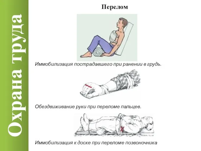 Охрана труда Перелом Иммобилизация пострадавшего при ранении в грудь. Обездвиживание руки