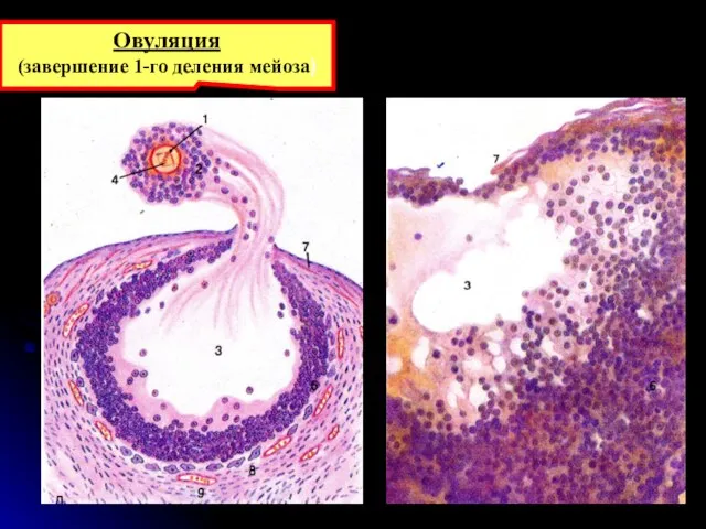 Овуляция (завершение 1-го деления мейоза)