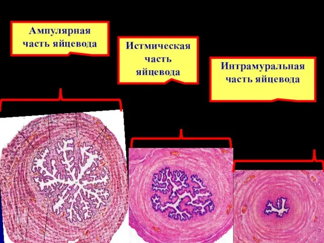 Ампулярная часть яйцевода Истмическая часть яйцевода Интрамуральная часть яйцевода