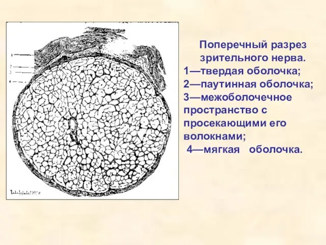 Поперечный разрез зрительного нерва. 1—твердая оболочка; 2—паутинная оболочка; 3—межоболочечное пространство с просекающими его волокнами; 4—мягкая оболочка.