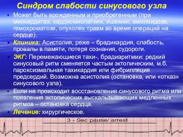 Синдром слабости синусового узла Может быть врожденным и приобретенным (при миокардитах,