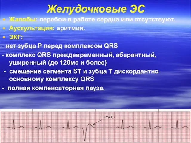 Желудочковые ЭС Жалобы: перебои в работе сердца или отсутствуют. Аускультация: аритмия.