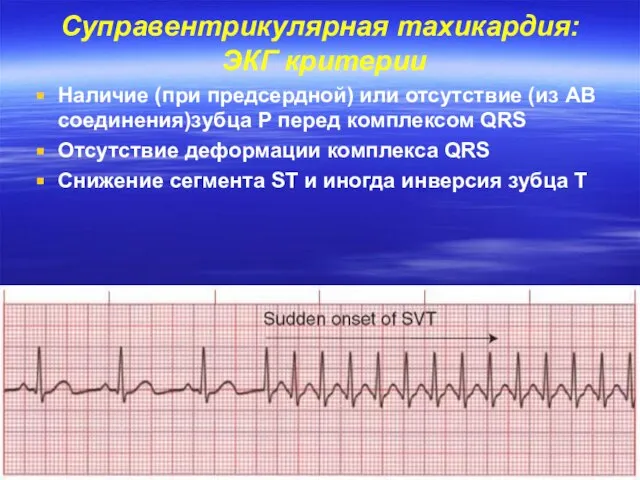 Суправентрикулярная тахикардия: ЭКГ критерии Наличие (при предсердной) или отсутствие (из АВ