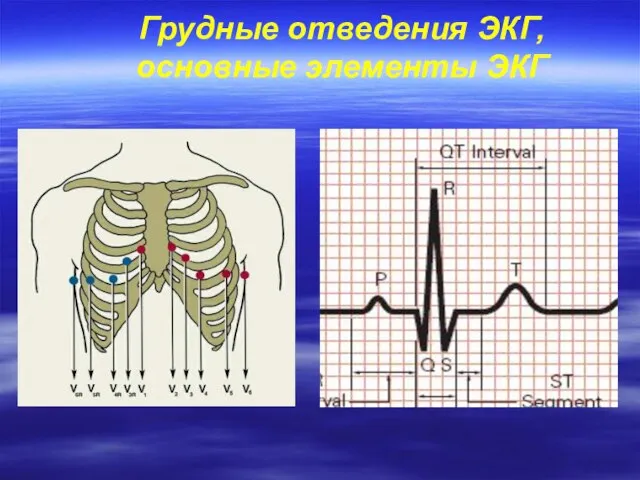 Грудные отведения ЭКГ, основные элементы ЭКГ