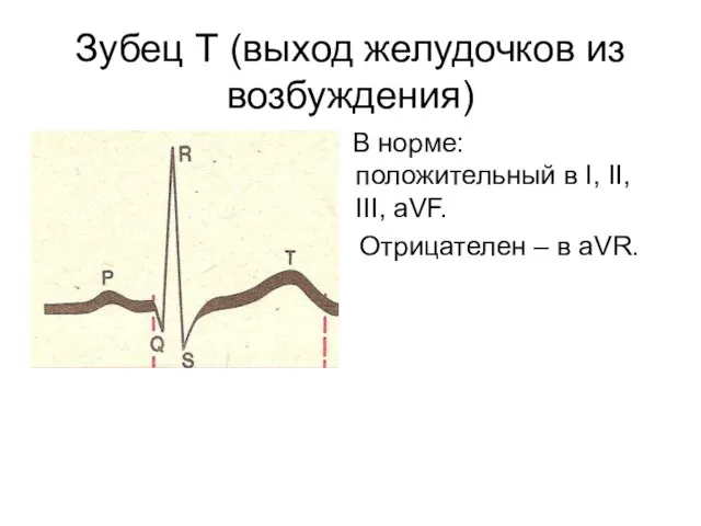 Зубец Т (выход желудочков из возбуждения) В норме: положительный в I,