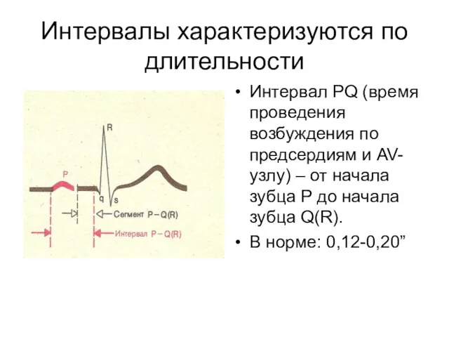 Интервалы характеризуются по длительности Интервал PQ (время проведения возбуждения по предсердиям