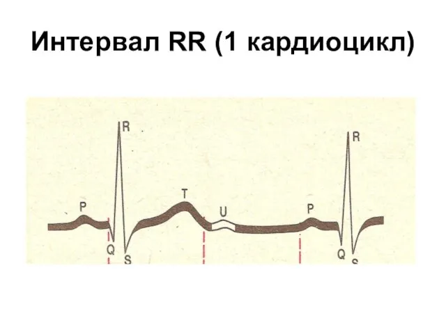 Интервал RR (1 кардиоцикл)