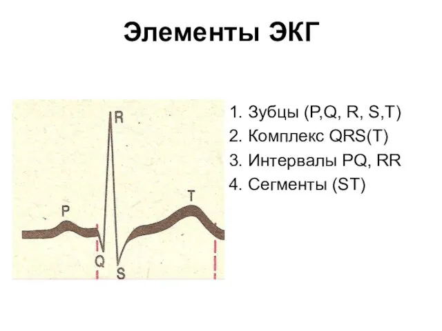 Элементы ЭКГ 1. Зубцы (P,Q, R, S,T) 2. Комплекс QRS(T) 3.