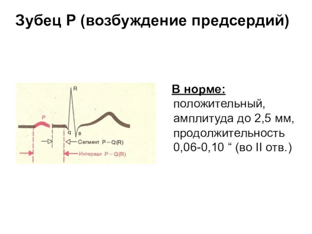 Зубец P (возбуждение предсердий) В норме: положительный, амплитуда до 2,5 мм,