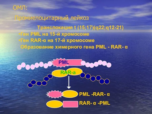 Tранслокация t (15;17)(q22;q12-21) Ген PML на 15-й хромосоме Ген RAR-α на