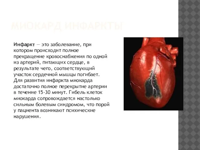 МИОКАРД ИНФАРКТЫ Инфаркт — это заболевание, при котором происходит полное прекращение