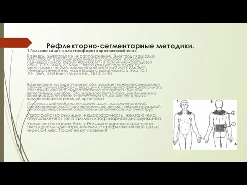 Рефлекторно-сегментарные методики. 1.Гальванизация и электрофорез воротниковой зоны. Размеры электродов и их