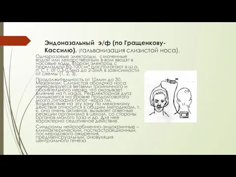 Эндоназальный э/ф (по Гращенкову-Кассилю). (гальванизация слизистой носа). Одноразовые электроды, смоченные водой