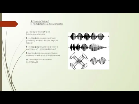 Формирование интерференционных токов: А- исходные колебания (несущие частоты Б- интерференционные токи(биения),